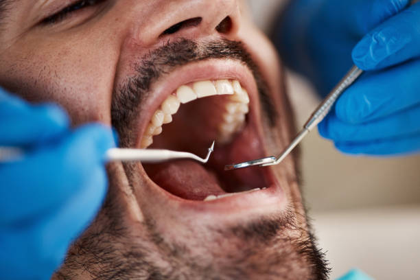 Best Knocked-Out Tooth Emergency  in Valley Center, CA